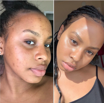 تونر ضدلک و روشن کننده اوله هنریکسن